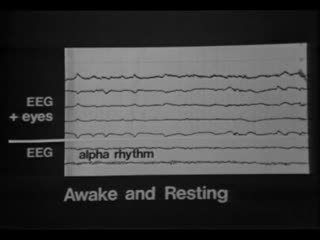 video preview image for Stages of Sleep