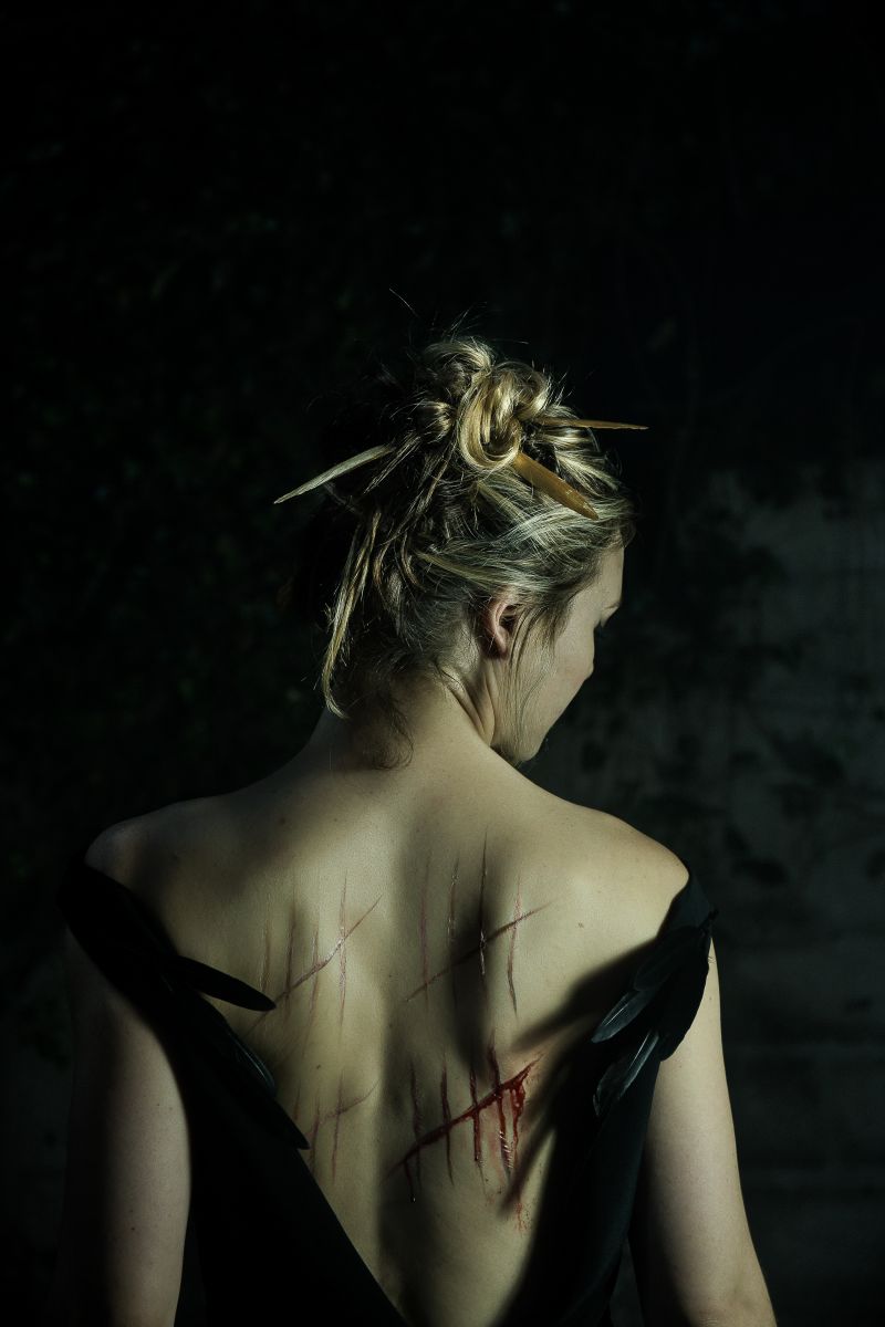 The scars of suffering. Photograph by Nicole Guarino.