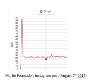 tour de france cyclist resting heart rate